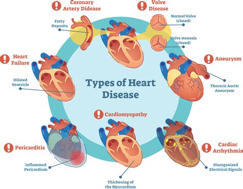 Enhanced Cardiovascular Well-being and Decreased Susceptibility to Heart Ailments