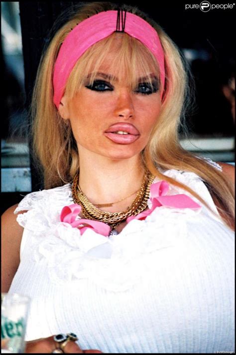 The Lolo Ferrari Phenomenon: How She Redefined Beauty Standards